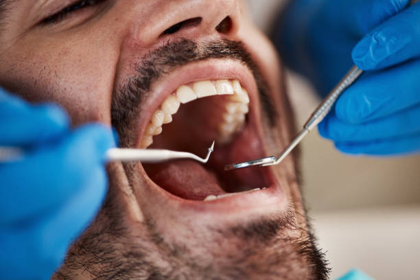 TMJ/TMD Treatment in Clarksville, TN